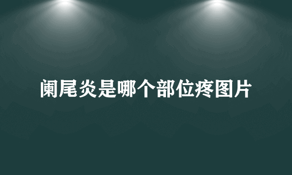 阑尾炎是哪个部位疼图片