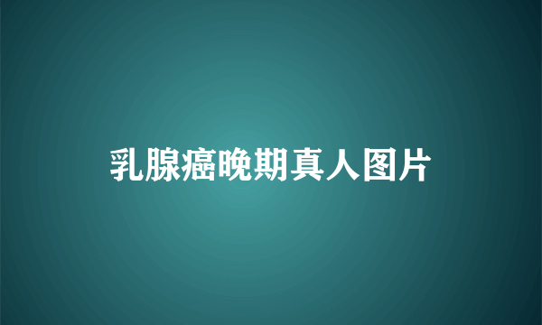乳腺癌晚期真人图片