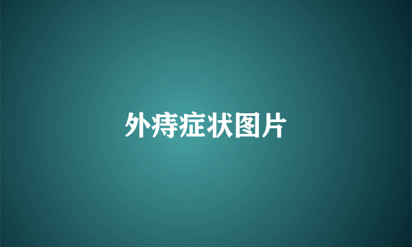 外痔症状图片