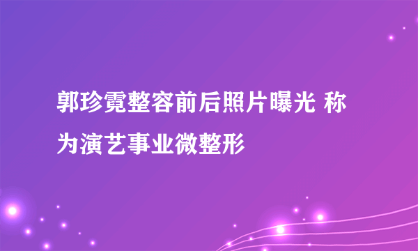 郭珍霓整容前后照片曝光 称为演艺事业微整形