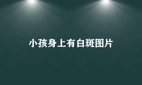 小孩身上有白斑图片