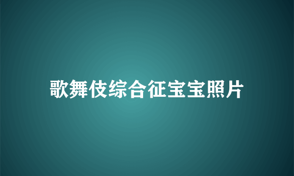 歌舞伎综合征宝宝照片
