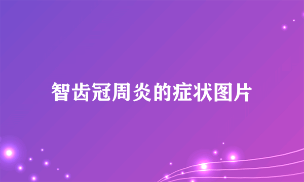智齿冠周炎的症状图片