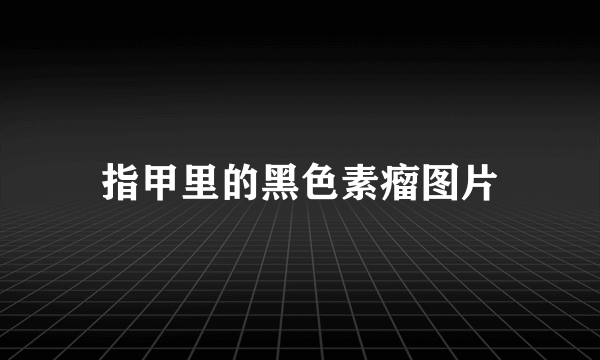 指甲里的黑色素瘤图片
