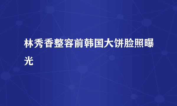 林秀香整容前韩国大饼脸照曝光