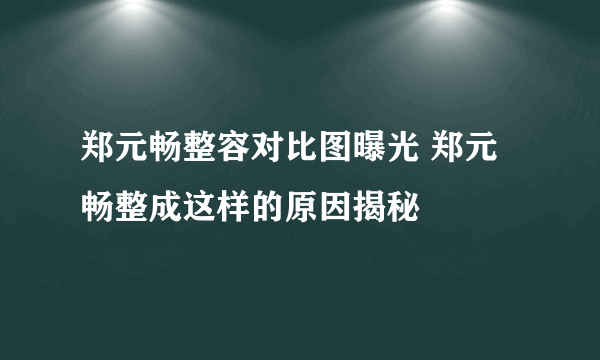 郑元畅整容对比图曝光 郑元畅整成这样的原因揭秘