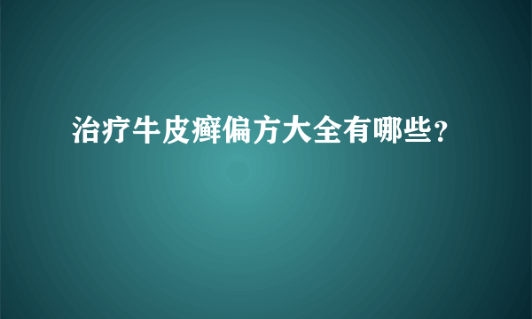 治疗牛皮癣偏方大全有哪些？