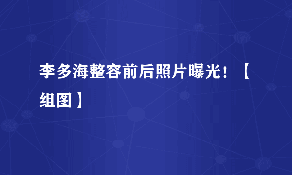 李多海整容前后照片曝光！【组图】