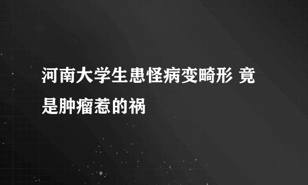 河南大学生患怪病变畸形 竟是肿瘤惹的祸