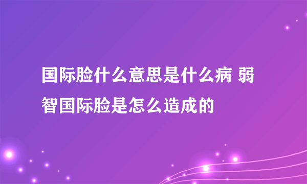 国际脸什么意思是什么病 弱智国际脸是怎么造成的