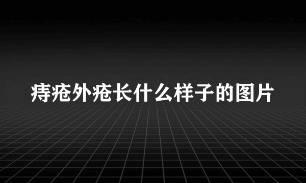 痔疮外疮长什么样子的图片