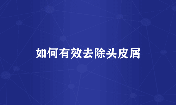 如何有效去除头皮屑