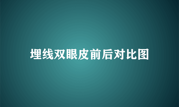 埋线双眼皮前后对比图