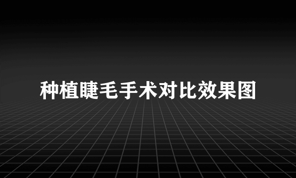 种植睫毛手术对比效果图