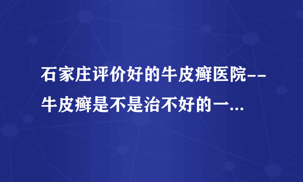 石家庄评价好的牛皮癣医院--牛皮癣是不是治不好的一种病吗？