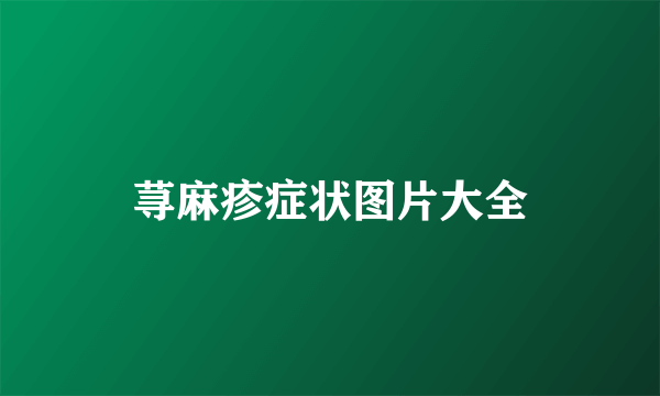 荨麻疹症状图片大全