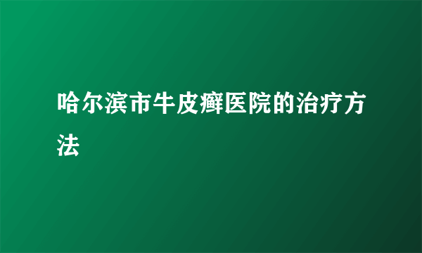 哈尔滨市牛皮癣医院的治疗方法