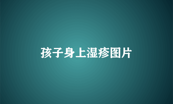 孩子身上湿疹图片