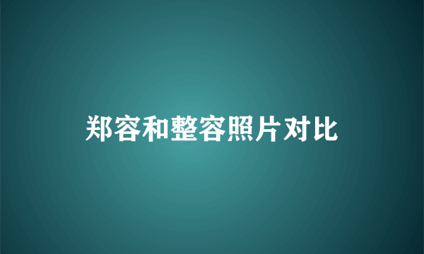 郑容和整容照片对比