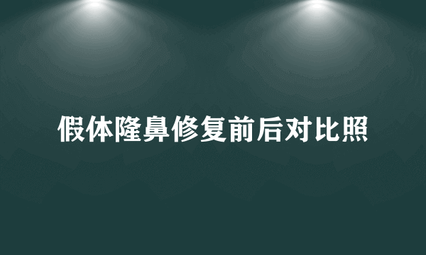 假体隆鼻修复前后对比照