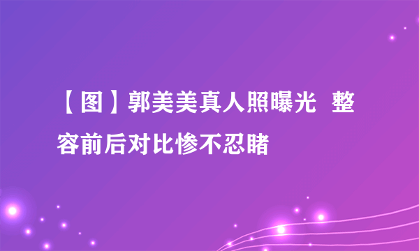 【图】郭美美真人照曝光  整容前后对比惨不忍睹