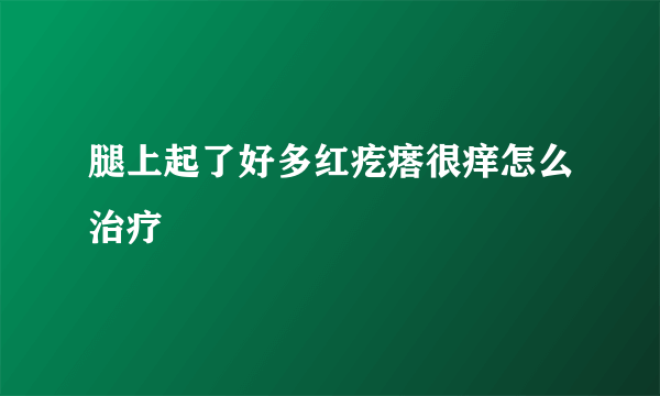 腿上起了好多红疙瘩很痒怎么治疗